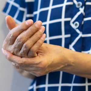 Photo of person rubbing hands arthritis.